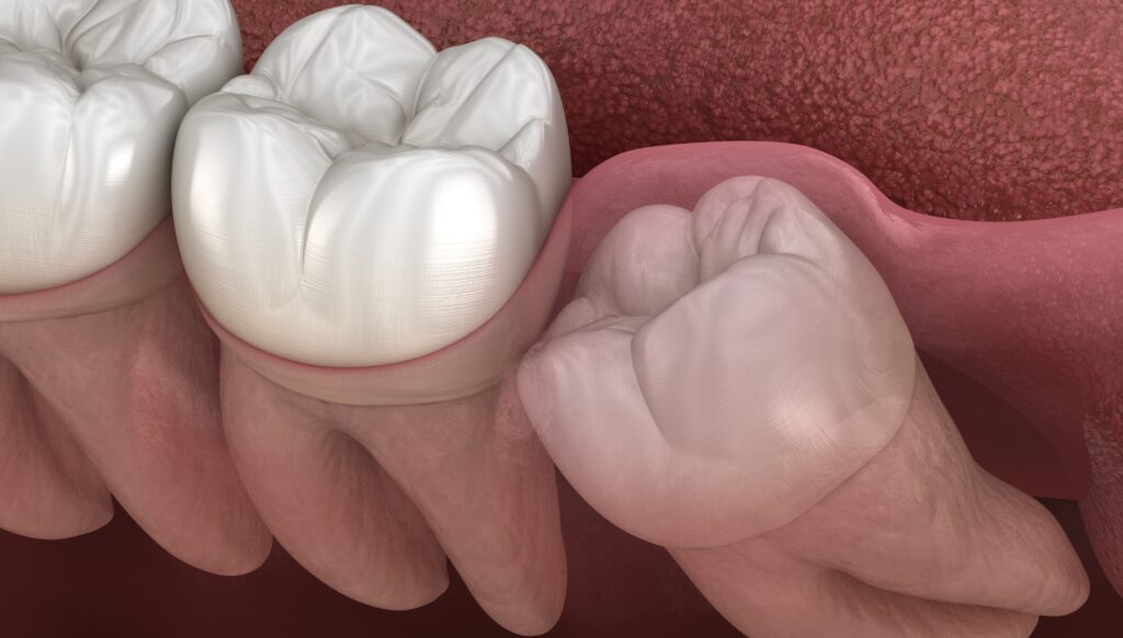 Noosa Hinterland Dental