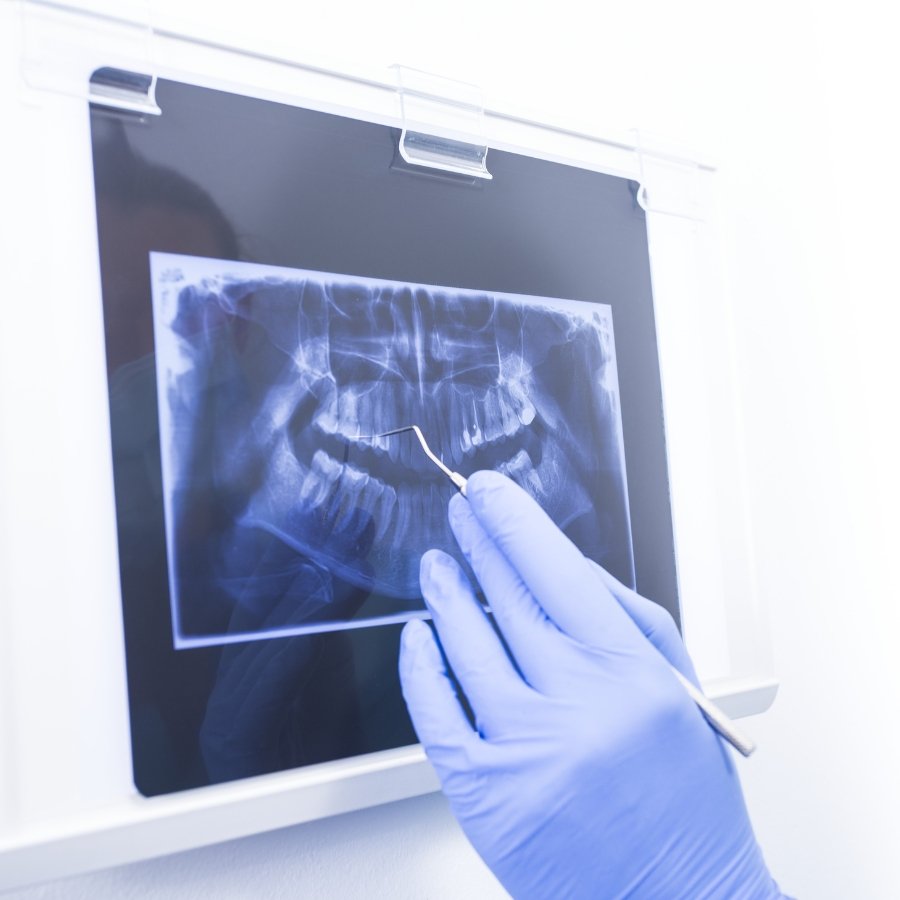 Low Dose Digital Radiography sunshine coast