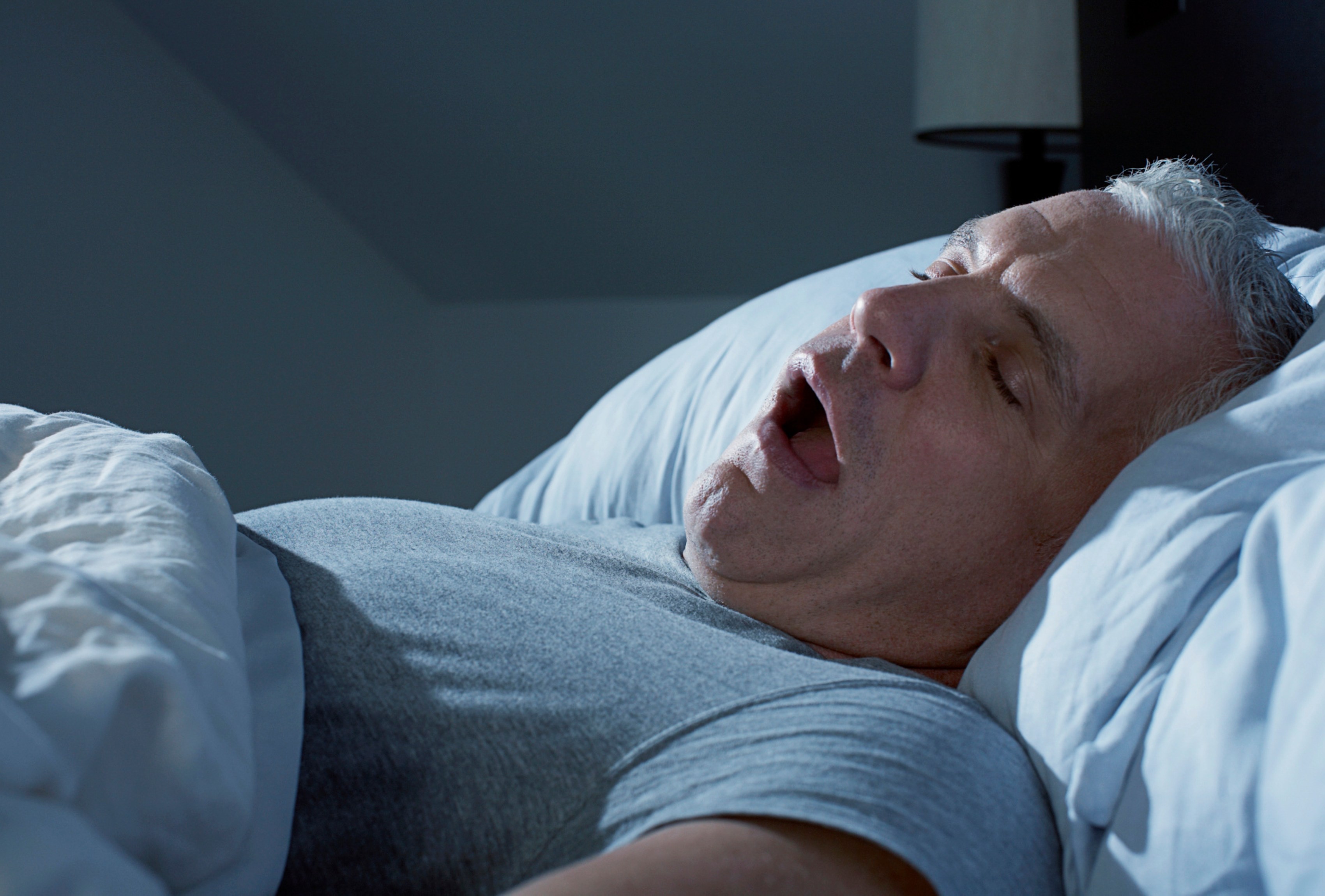 Man sleeping with mouth open, illustrating snoring and sleep apnoea treatment at our Pomona clinic.