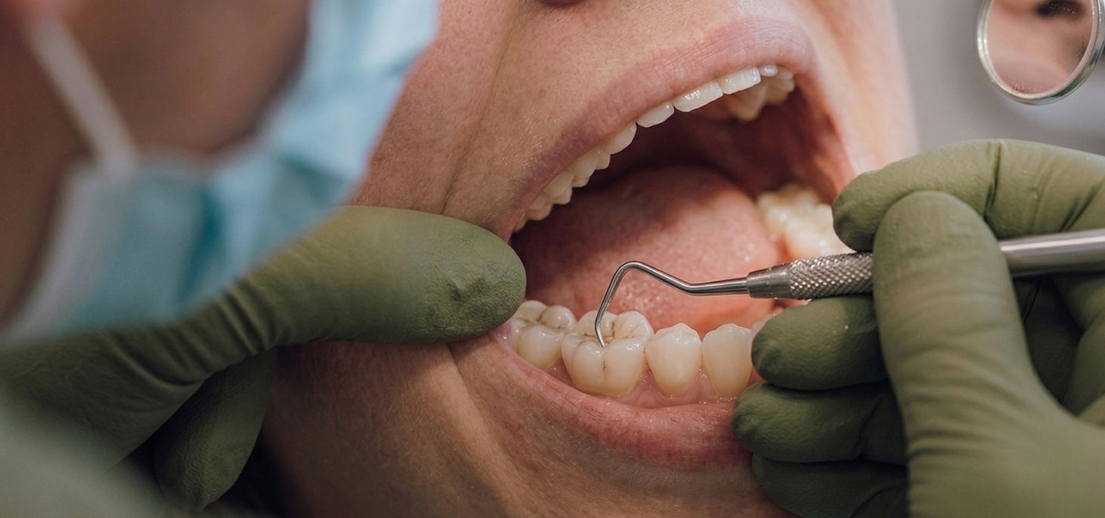Patient receiving gum disease treatment at Noosa Hinterland Dental in Pomona